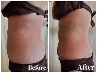 【大名】 NicoLのエステ・リラクイメージ