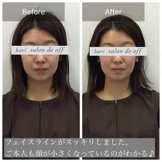 整体×美容鍼灸 鍼灸師Miyanoのエステ・リラクイメージ