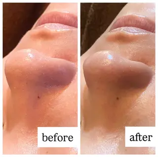 肌質改善専門 ハーブ /毛穴洗浄 リエイトのエステ・リラクイメージ