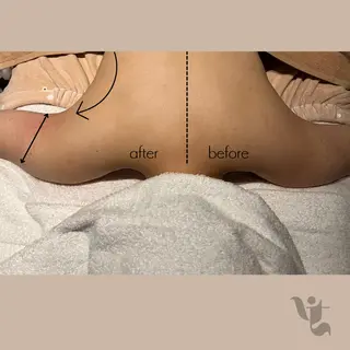 【vidyto】ヴィディトゥ所属・肌管理サロン vidyto　MOEのエステ・リラクイメージ