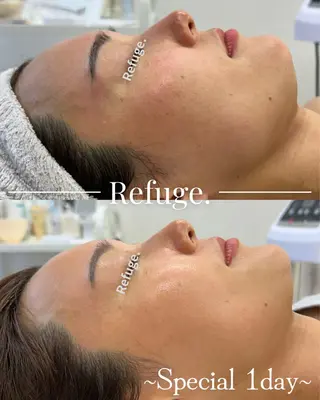 グリーンピール専門サロン Refuge.所属・Refuge. （リフュージュ）のエステ・リラクイメージ