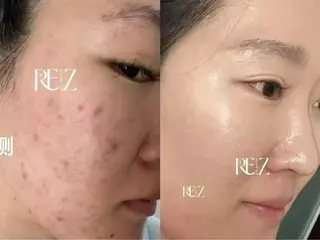 メディカルエステ　痩身·小顔専門サロンBBC 田園調布所属・KEI KOのエステ・リラクイメージ