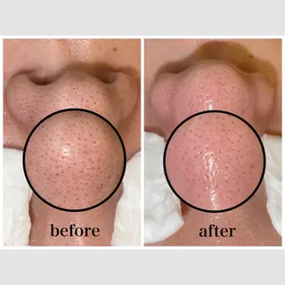 韓国肌管理 【毛穴専科】のエステ・リラクイメージ