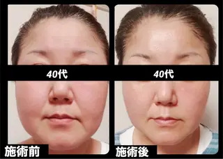 夜エステサロン🌷Luana所属・夜サロン♡ Luana🦋.*˚のエステ・リラクイメージ