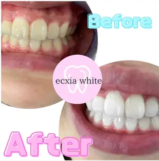 メンズ エクシアホワイトニング草津店所属・nanami -ホワイトニングのその他イメージ