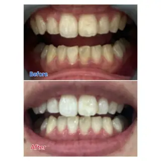 MBEAUTYSALON 千葉店・京成大久保所属・Melty 輝のその他イメージ