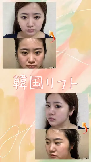 マツエク・マツパ 愛維美水光美肌専門店所属・愛維美水光美肌専門店 メンズレディースokのエステ・リラクイメージ