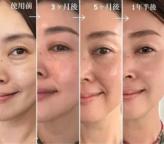 小顔/たるみ/黒ずみ除去専門サロン/SONA 大和西大寺店所属・【小顔専門看護師 サロンSONA】のエステ・リラクイメージ