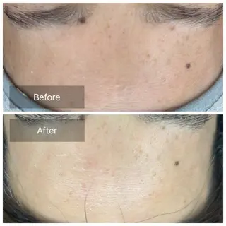 トータルしみケア専門 NICA(ニカ)のエステ・リラクイメージ