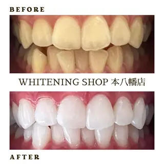 メンズ ホワイトニング ショップ本八幡店のエステ・リラクイメージ