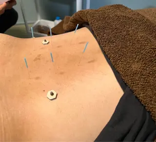 たくみ鍼灸整体所属・後藤 巧のエステ・リラクイメージ