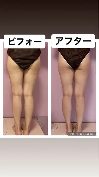 ビューティーサロンパピヨン所属・小林 沙英のエステ・リラクイメージ