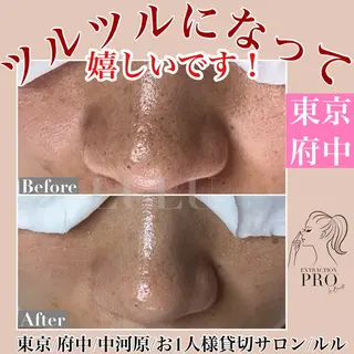 LULU所属・LULU ルルのエステ・リラクイメージ