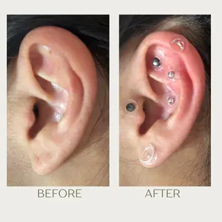 ピーリングケア 🤍moekoのエステ・リラクイメージ