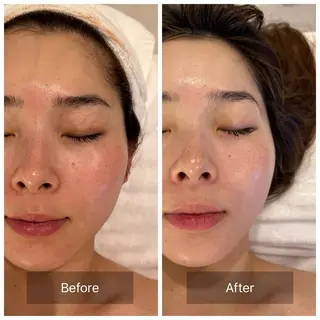 mine.mマインエム所属・mine.mi マインエムのエステ・リラクイメージ