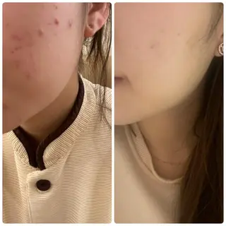 肌質改善美容サロン ému 用賀のエステ・リラクイメージ