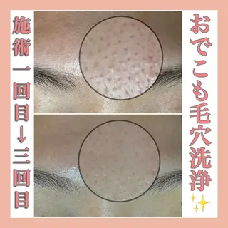 ecle ericaのエステ・リラクイメージ