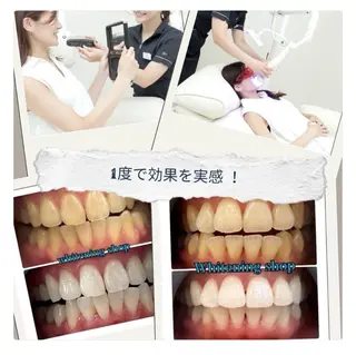 セルフ　ホワイト ニングショップ立川のその他イメージ