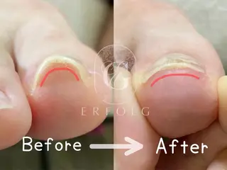 ネイル ネイル スクールのネイルデザイン