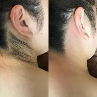 六本木脱毛andS 店長Sachiのエステ・リラクイメージ