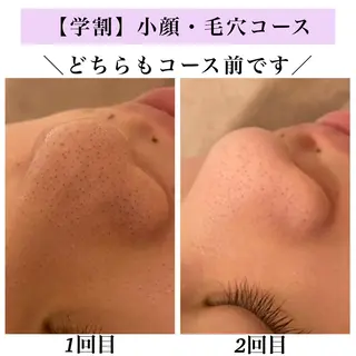 Bellesthe （ベルエステ）のエステ・リラクイメージ