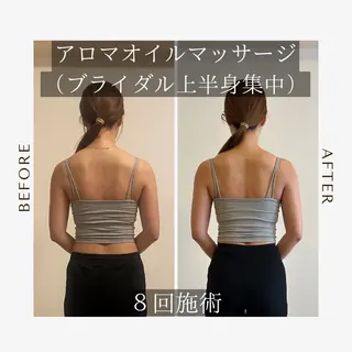 鍼灸•マッサージサロンCalfa所属・《美肌･小顔》美容鍼 ＆マッサージ＊MEIのエステ・リラクイメージ