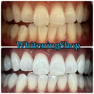 ホワイトニング ショップ吉祥寺店のエステ・リラクイメージ