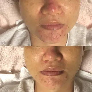 エスカル ボーテのエステ・リラクイメージ