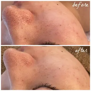 メンズ メナード岐阜市茜部 杉浦のエステ・リラクイメージ