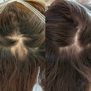 毛穴専門店MeMe.八千代店所属・\毛穴・頭皮/ のお悩みに特化💪のその他イメージ