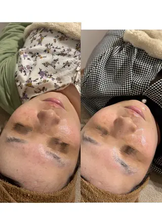 LUMIERE 福岡のエステ・リラクイメージ