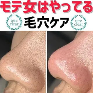 毛穴肌質ケアサロン Yourmeユアミーのエステ・リラクイメージ