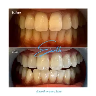 ホワイトニングサロン EARTH目黒店のその他イメージ