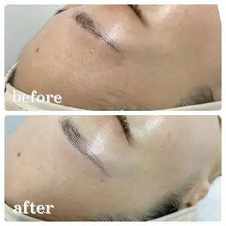 AKI 【lazo】のエステ・リラクイメージ