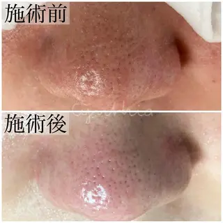 毛穴ケア専門店 Cynthiaのエステ・リラクイメージ