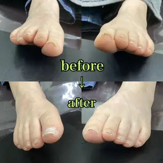 ネイル ヒューマン 鍼灸接骨院所属・リラク/ネイル/ 足裏ケア/蛭川栞のエステ・リラクイメージ