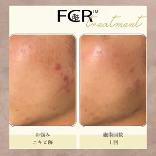 奥村 まよのエステ・リラクイメージ