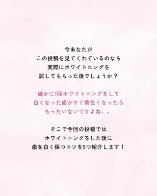セルフホワイトニング エクシア大曽根店のその他イメージ