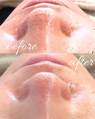 abbellina×UNO出雲塩冶店《ウノ》所属・フェイシャルエステ 🫧琉衣のエステ・リラクイメージ