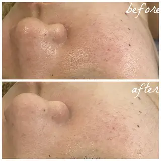 メンズ メナード岐阜市茜部 杉浦のエステ・リラクイメージ