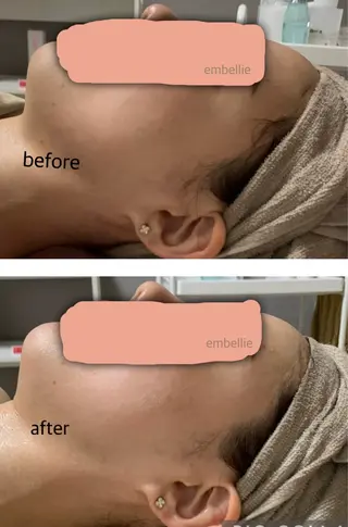 miyasaka erikoのネイルデザイン