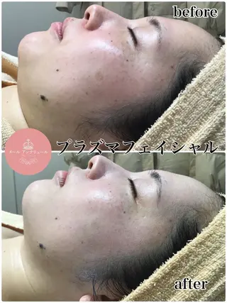 メールアンテリュール OKADAのエステ・リラクイメージ