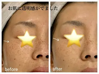 Freesia total beauty所属・熊谷 かおりのエステ・リラクイメージ