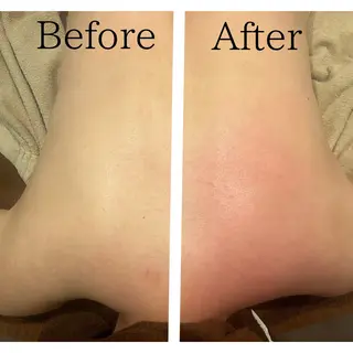 筋膜/リンパ/深層/ スポーツ/アロマ/のエステ・リラクイメージ