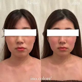 エステサロンino.colore'所属・小顔サロン ino.coloreのエステ・リラクイメージ