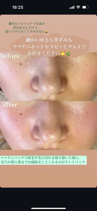 nature  s oin ICHIKAのエステ・リラクイメージ