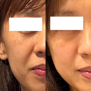 小顔エステsakura🌸belle(サクラベル)所属・小顔エステ サクラ🌸ベルのエステ・リラクイメージ