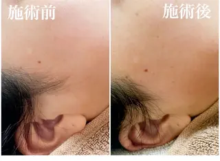 U eyes ちかのマツエク・マツパデザイン