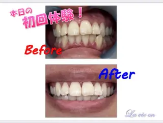 セルフホワイトニングサロン　ラヴィアン所属・ホワイトニングサロン La vie enのその他イメージ