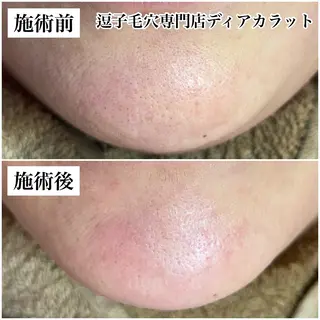 毛穴専門店　dear Ct.所属・毛穴専門店 ディアカラットのエステ・リラクイメージ